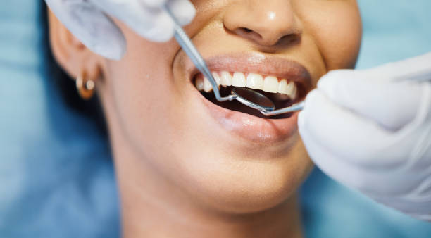 Best Cosmetic Emergency Dentistry in Aberdeen, IN