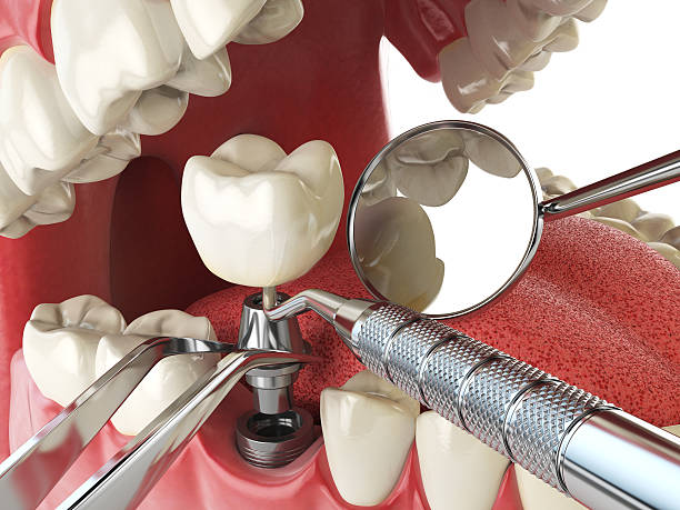 Best Emergency Gum Treatment in Aberdeen, IN